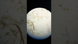 zooplankton movements  copepods marineanimal microscopiclife plankton marinebiology [upl. by Lorena636]