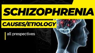 Etiology of Schizophrenia Causes of Schizophrenia UrduHindi wellnessbyfarah [upl. by Aivyls]