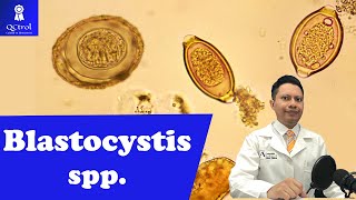 Conoce a Blastocystis spp Morfología y CLAVES para su identificación Laboratorio de parasitología [upl. by Darryl]