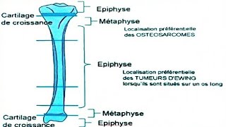 Tumeurs osseuses malignes primitives [upl. by Battista]