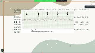 Monitoreo Fetal [upl. by Jan152]