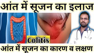 आंत में सूजन का इलाज 🔥Aant me sujan ka ilaj  Aat me sujan ke lakshan Colitis ka gharelu ilaj [upl. by Enidanreb]