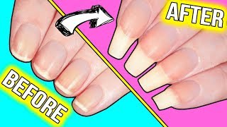 How to GROW YOUR NAILS FAST actually helpful information [upl. by Jerroll110]