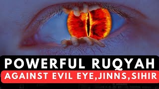 Powerful Ruqyah DUA Against Bad EvilEyeBlack magic Sihir Jinns amp Jealousy dua ruqyah [upl. by Trask]