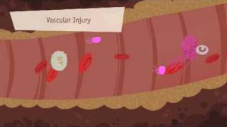 Hemostasis Coagulation and Fibrinolisis [upl. by Eneleh]