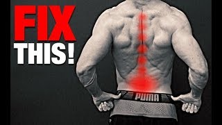 How to Fix a Bulging Disc NO SURGERY [upl. by Ahsiekam]