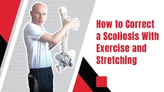 How to Correct a Scoliosis With Exercise and Stretching  Edward Paget [upl. by Suivat]