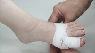 Toe Bandaging Principles and Tips [upl. by Naitirb]