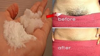 How to Remove Pubic Hair Permanently Naturally in 5 Minutes [upl. by Eelaras]