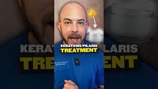 What is keratosis pilaris Derm explains keratosispilaris [upl. by Lepper]