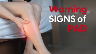 The Signs of Peripheral Artery Disease You Need to Know [upl. by Domela]