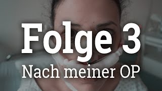 Nach meiner NasenOP  VLog Septorhinoplasty  Folge 3 [upl. by Livvyy]