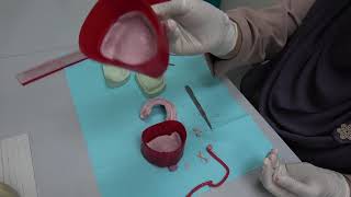 COMPLETE DENTURE 3 Preparation of Working Cast [upl. by Krug]