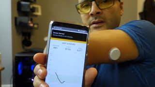 Freestyle Libre Sensor Application  How to Control Diabetes  How to Lower A1C [upl. by Cruz307]