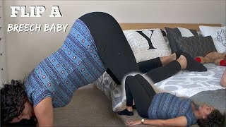 HOW TO FLIP BREECH BABY  YANELY AMADIZ [upl. by Yrrep618]