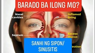 PAANO HILOTIN ANG BARADONG ILONG DAHIL SA SIPON O SINUSITIS SAAN ANG REFLEX POINTS NITO [upl. by Hedvig]