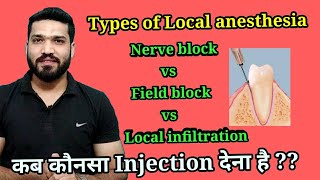 Types of Local anesthesia Injection [upl. by Cyprio]