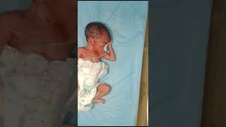 obed This newborn baby Hypotonia lack of healthy mother this newborn baby very thin body [upl. by Swayne119]