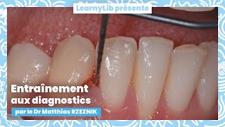 🦷 La parodontie  entraînement aux diagnostics avec le Dr Matthias RZEZNIK [upl. by Notsniw]