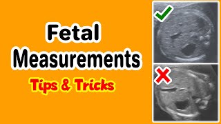 Fetal Measurements Tips and Tricks [upl. by Darom]