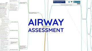 AIRWAY ASSESSMENT [upl. by Odella]