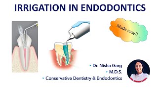 IRRIGATION IN ENDODONTICS  SODIUM HYPOCHLORITE  MCQs [upl. by Norahc]