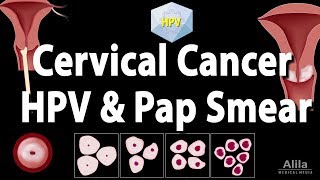 Cervical Cancer HPV and Pap Test Animation [upl. by Amrac756]