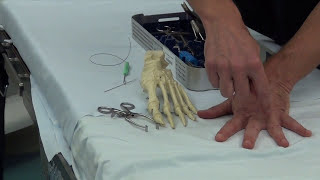 Toe Splay Correction Surgery Explained  Using the Arthrex Plantar Plate Repair System [upl. by Ingeberg]