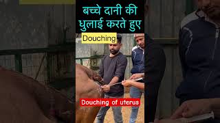 Douching of uterus l dr Umar khan [upl. by Fennessy465]