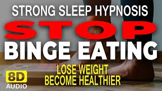 VERY STRONG Sleep Hypnosis to Stop Binge Eating  Lose Weight and Become Healthier  Dark Screen [upl. by Hurff]