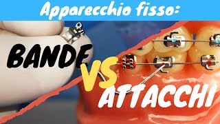 Bande VS attacchi apparecchio fisso [upl. by Acalia]