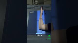 forearm xray radiography medicalstudent shorts [upl. by Ahsenet116]