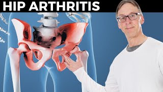 How Bob Relieves His Hip Arthritis In 10 Minutes [upl. by Hylan]