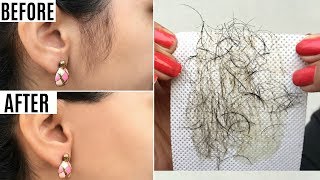 Instant FACE Hair Removal  10 Ways to PERMANENTLY Get Rid of FaceBody Hair  Anaysa [upl. by Yanarp]