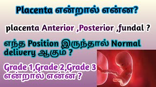 placenta positions tamil  Anterior posterior  fundal  placenta previa  grade1 grade 2  grade3 [upl. by Ubald]