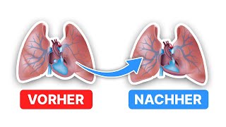 SO vermeidest du niedrigen Blutdruck [upl. by Uok]