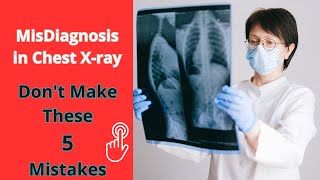 ✅ Save Patients Life Mastering Chest XRay Interpretation chestxray xray [upl. by Ahsikyw]