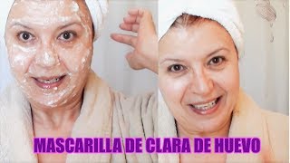 MASCARILLA DE CLARA DE HUEVO ANTIARRUGAS Y POROS ABIERTOS  Mascarilla casera y natural  EMDG [upl. by Aibonez]