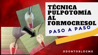 Técnica PULPOTOMÍA AL FORMOCRESOL  paso a paso [upl. by Amjan]