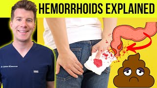 Doctor explains HEMORRHOIDS aka piles  Causes symptoms treatment amp prevention [upl. by Annhej525]