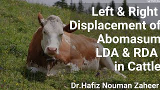 Displacement of AbomasumLDARDATreatment protocolComplete Lecture By Dr Hafiz Nouman Zaheer [upl. by Nerek96]