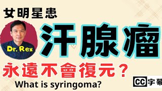 女明星有汗腺瘤永遠不會痊愈？syringoma a never healing problem [upl. by Irama]