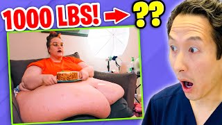 Plastic Surgeon Reacts to MY 600 LB LIFE She went from 1000 lbs to [upl. by Gusta876]