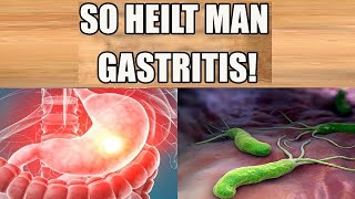 Gastritis heilen Beseitige deine Gastritis schnell und natürlich  Einfaches Heilmittel [upl. by Settera514]