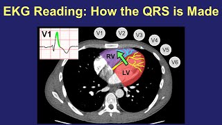 EKG Reading How the QRS is Made [upl. by Adachi517]