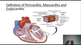 LEARN ABOUT PERICARDITIS MYOCARDITIS AND ENDOCARDITIS [upl. by Kalagher]