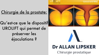 Urolift traiter ladénome de la prostate tout en préservant les éjaculations cest possible [upl. by Ainsworth]