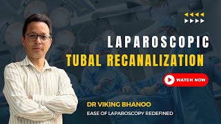 Lap Tubal Recanalization  Under SA BL Pyosalpinx [upl. by Reinnej289]