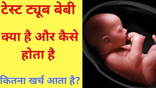 Test tube baby process in hindi [upl. by Siger]