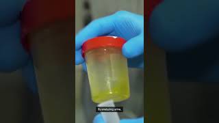 Urinalysis Explained [upl. by Fabe]